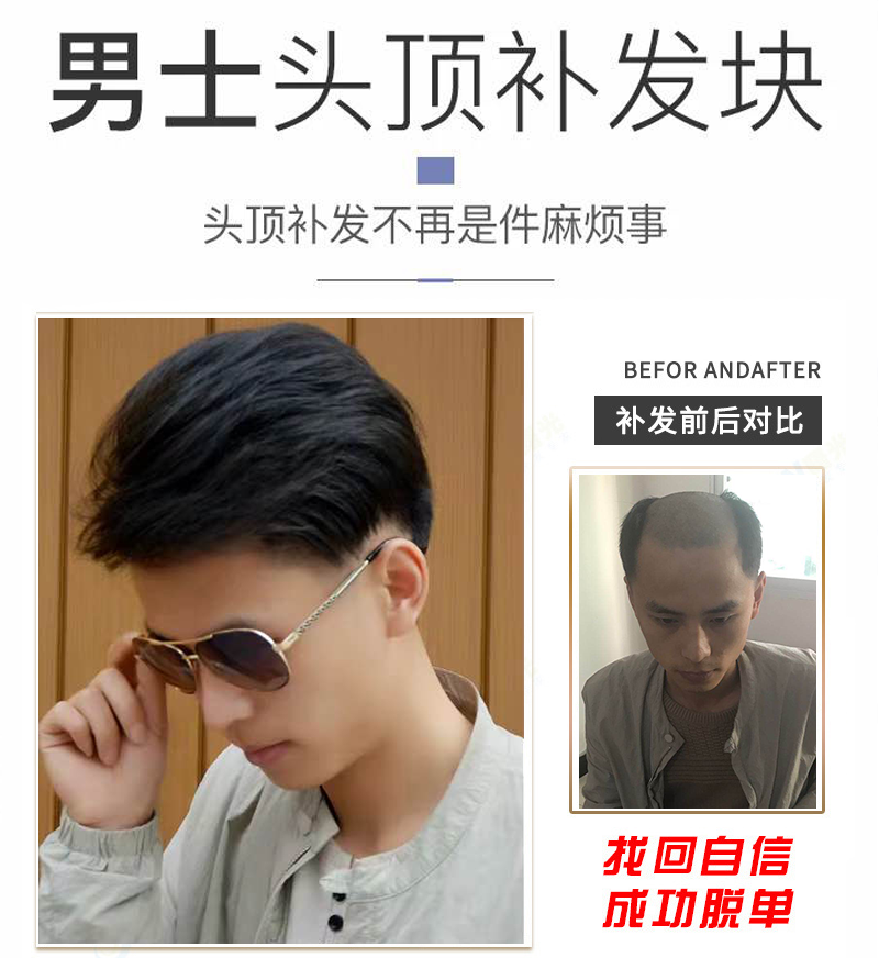 男士假发套青年男士生物头皮假发男帅气韩版短发前额地中海头顶补发片