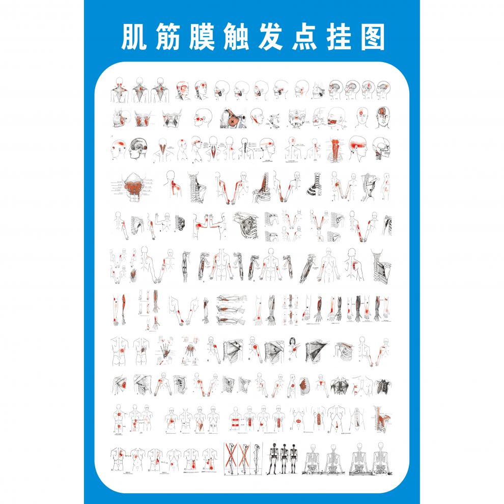 2022新款可狄激痛点肌筋膜疼痛触发点示意图解人体肌肉解剖图解墙贴