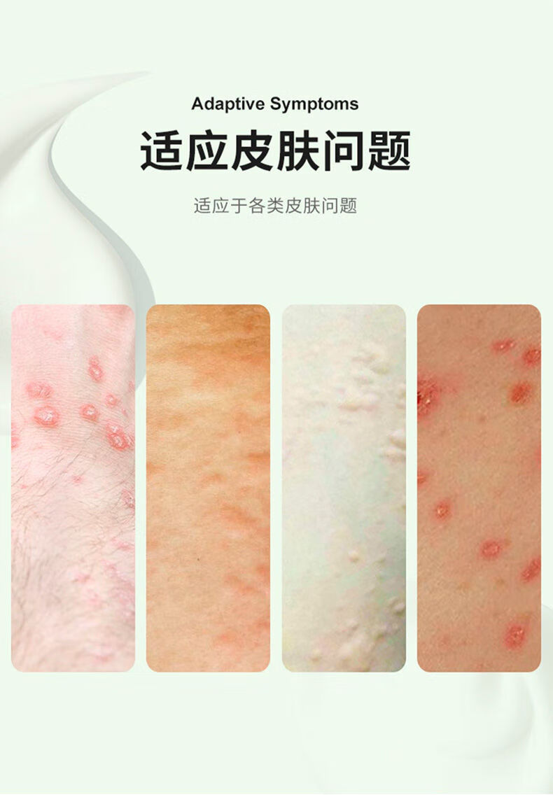 梵赞克洛芬软膏 硫磺软膏草本复方牛黄5%儿童阴虱阴囊潮湿螨虫一扫光