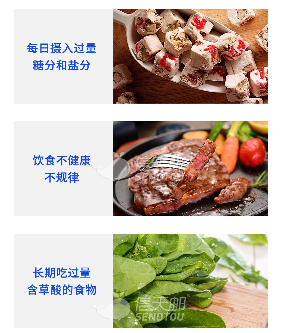 yy日本优克龙肾结石尿路结石药原装进口优客隆柳栎浸膏胶囊urocalun