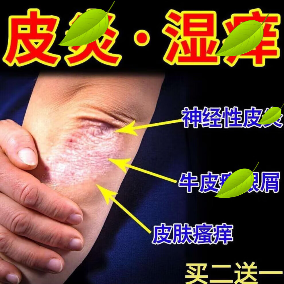 hkcqcq【官方旗舰】普萘洛尔软膏云南本i草止痒灵皮u炎湿u疹皮肤瘙痒