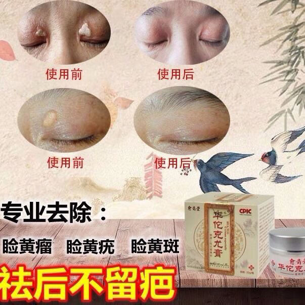 官方旗舰除睑黄疣圆眼部睑黄瘤膏睑黄瘤睑黄疣膏眼瘤脂肪粒汗管疣眼部
