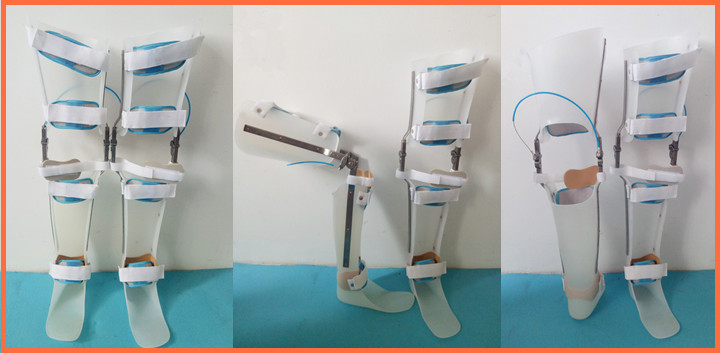 成人膝踝足中风偏瘫儿麻截瘫矫形器行走支具大腿矫形器定制落环锁右腿