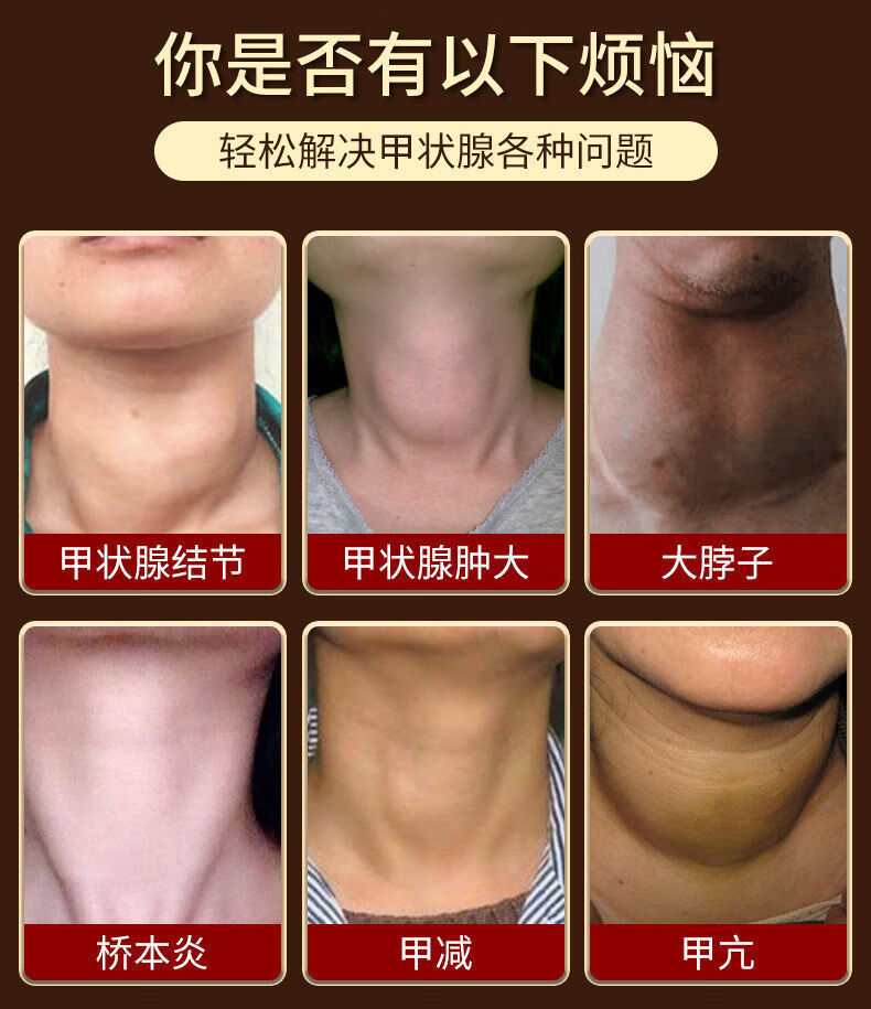 正常甲状腺脖子的照片图片