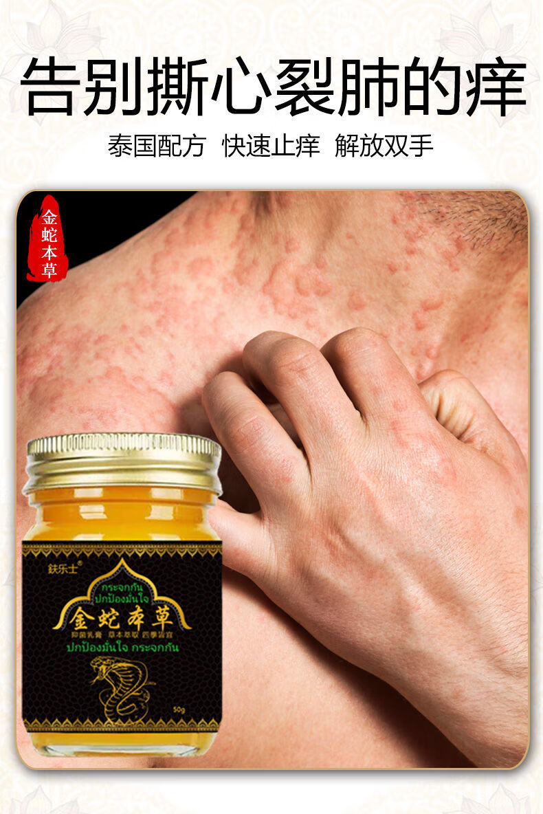 【官网精选】金蛇本草乳膏皮肤瘙痒皮p癣专用屑银湿s疹皮肤瘙痒癣股体
