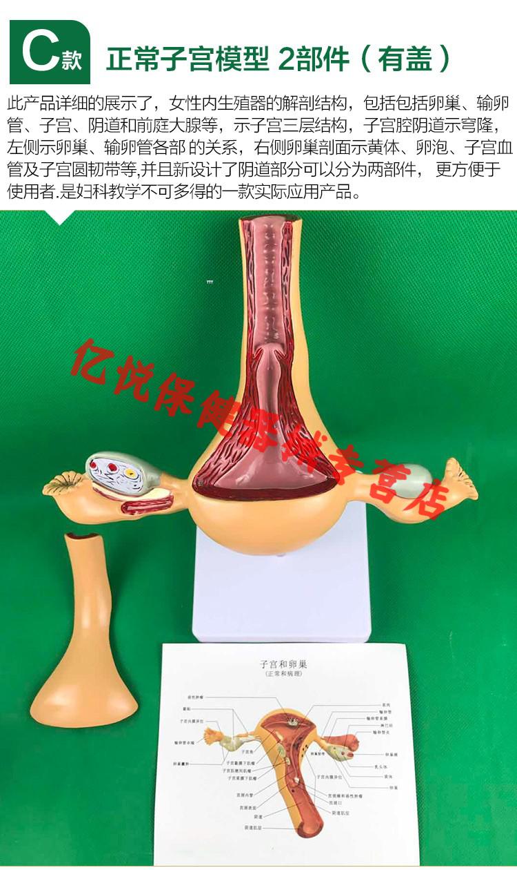 子宫模具图片