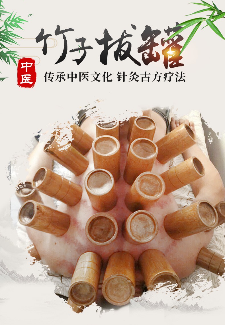 20个竹罐拔罐碳化竹子拔火罐吸湿木罐竹筒罐30罐家用套装 b款背部专用