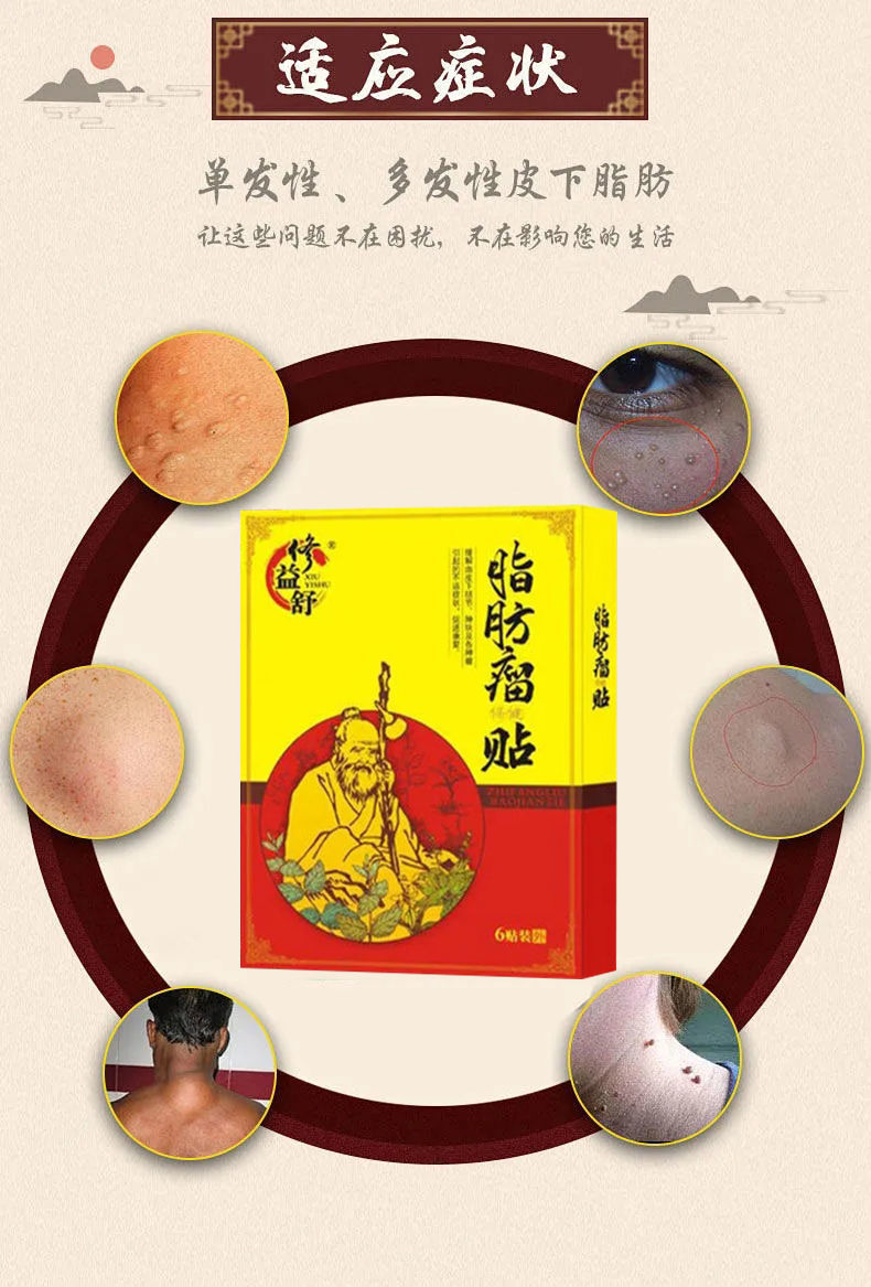 脂肪瘤消除贴单发性多发性脂肪瘤皮下脂肪瘤纤维瘤去ll脂肪ll粒神i器