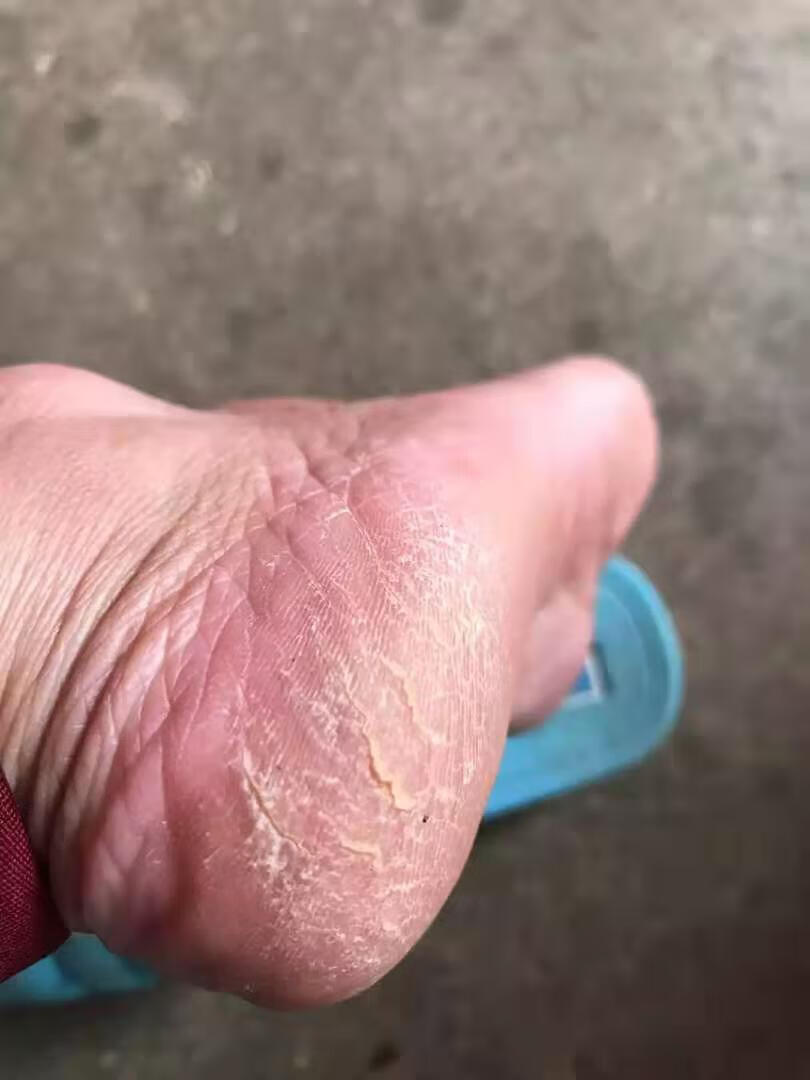 京东优惠券_京东特价券_内部优惠券_京东商城优惠券_真的很划算