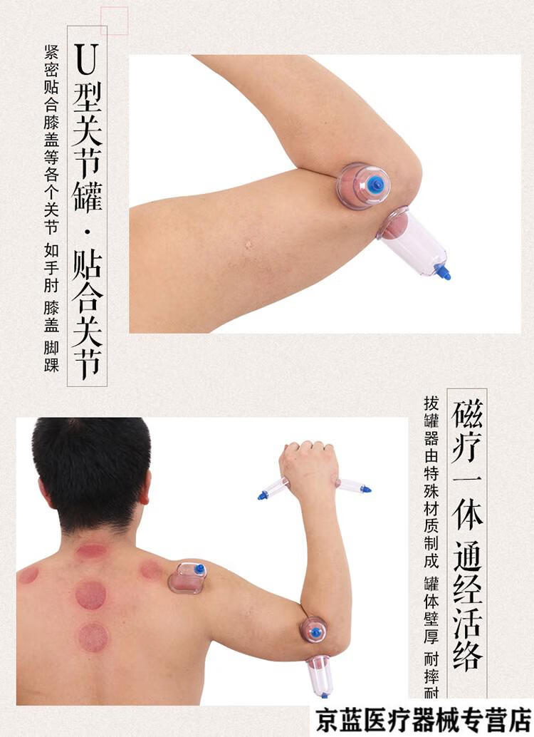 排瘀罐泻血罐韩国心天泻血疗法放血罐真空拔罐器放血罐笔排淤罐 13头