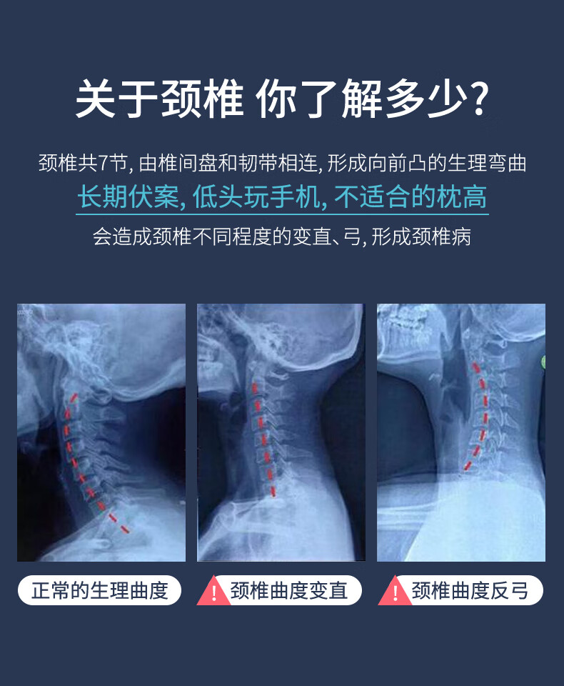 2022新款脖子前傾枕頭富貴包脖子前傾器睡覺頭部前傾枕頭反弓頸椎曲度