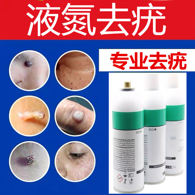 液氮冷冻疣小瓶 去疣小瓶装治疣瘊子丝状疣扁平疣寻常疣点痣痦子神器