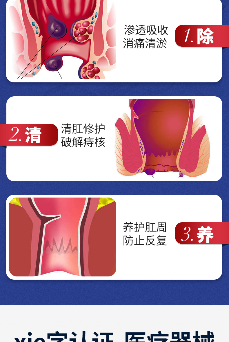 同仁堂痔疮灵膏肉球冷敷凝胶可搭去腚消内外混合治肛门瘙痒便血脱肛裂