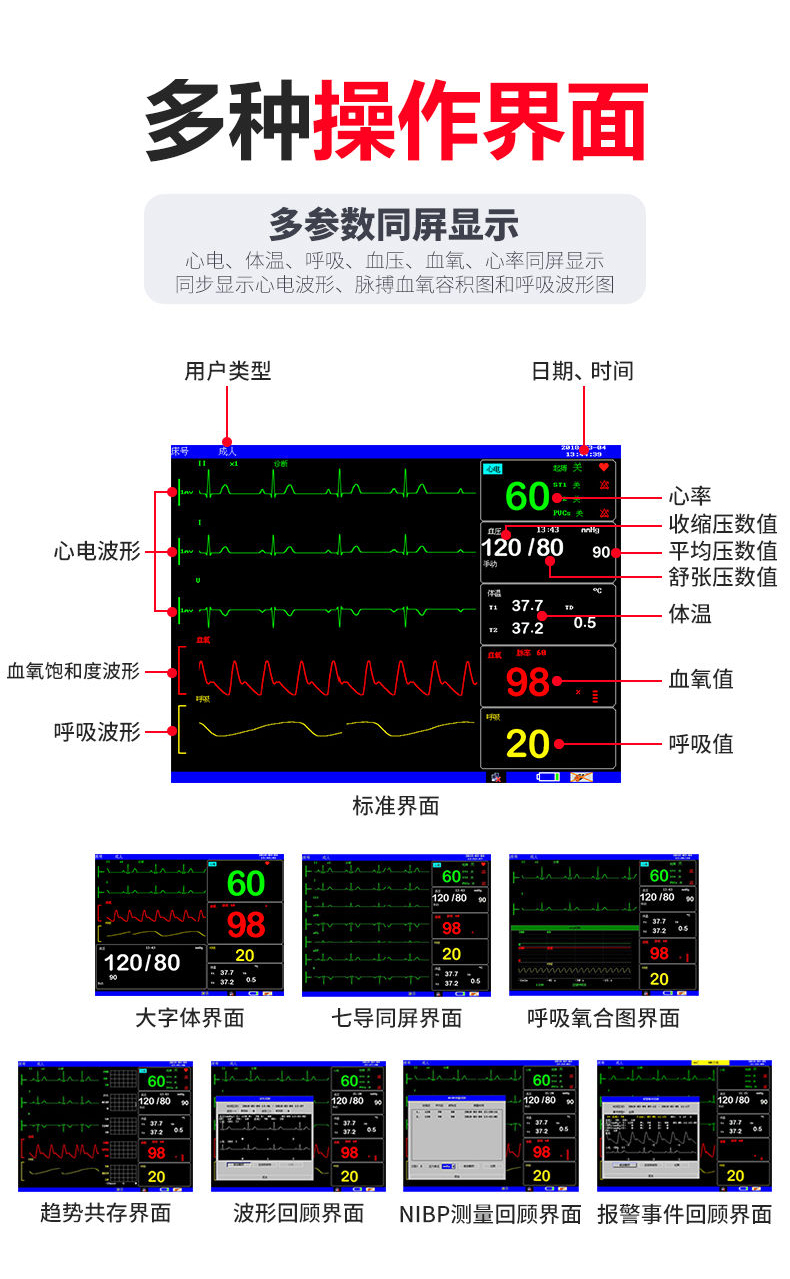 心电监护仪怎么看图解图片