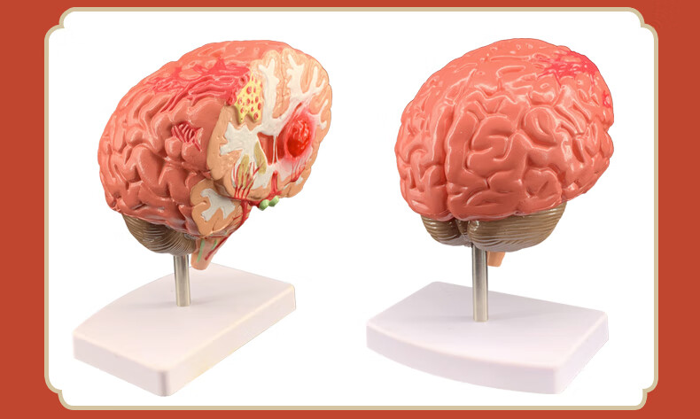 2021新款人体器官解剖模型大脑结构层次模块医院学校教学演示摆件可