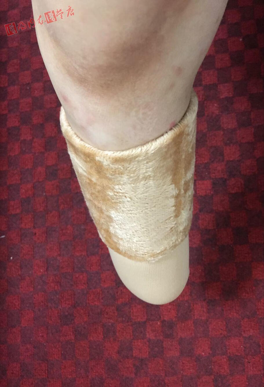 2只装加厚绒毛袜纯棉残肢袜残疾人袜子小腿截肢袜假肢袜套义肢袜 宽10