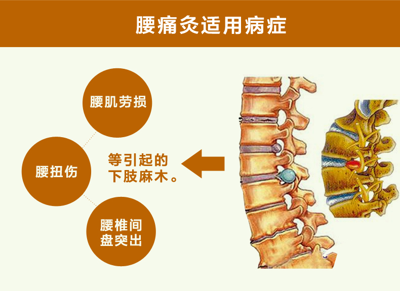 久火鎮痛灸腰痛灸貼膏發熱貼咳嗽腰頸椎肩周落枕貼腿疼痛止痛腰間盤