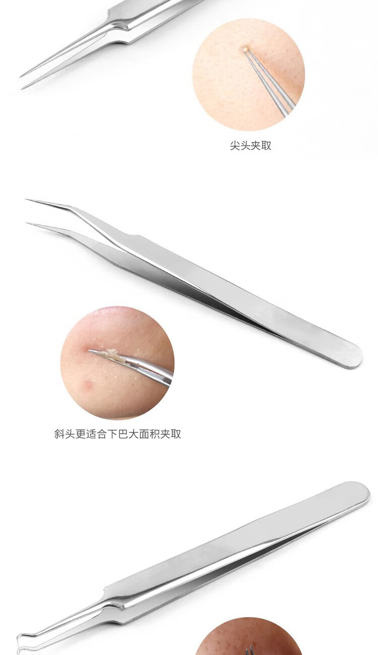 阿嚓热粉刺针头镊子家用美容挤痘痘工具细胞夹挑暗疮针套装拔去黑 弯嘴夹+收纳盒