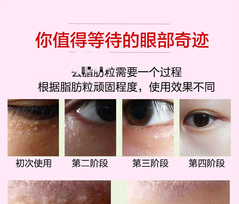 去脂肪粒草本精华液去脂肪粒油脂粒汗管粒眼部修复霜