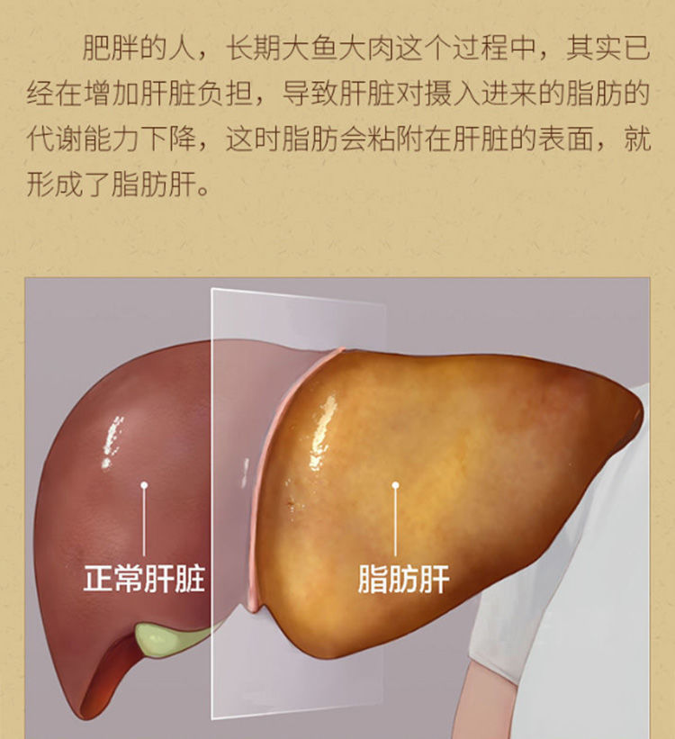 脂肪肝克星肪肝养肝利肝乏力恶心食欲减退腹部疼痛膏贴五盒周期装