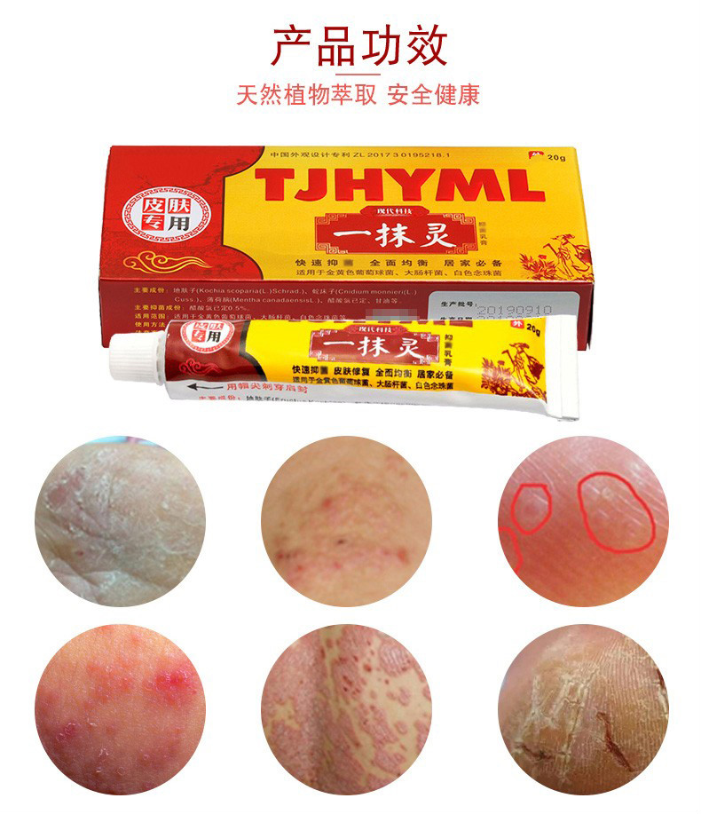 tjh一抹灵乳膏脱皮痒软膏皮肤湿痒外用私i处止痒膏一盒装