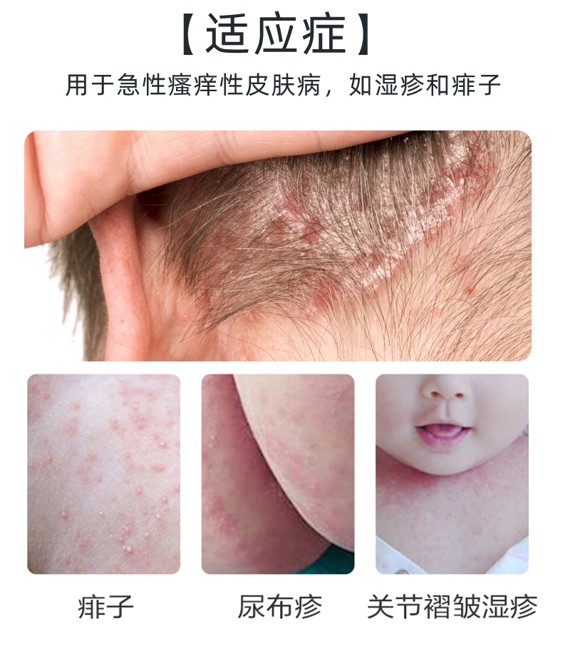 瑞林爐甘石洗劑60ml皮膚瘙癢痱子兒童止癢身上癢外用新生兒溼疹10瓶