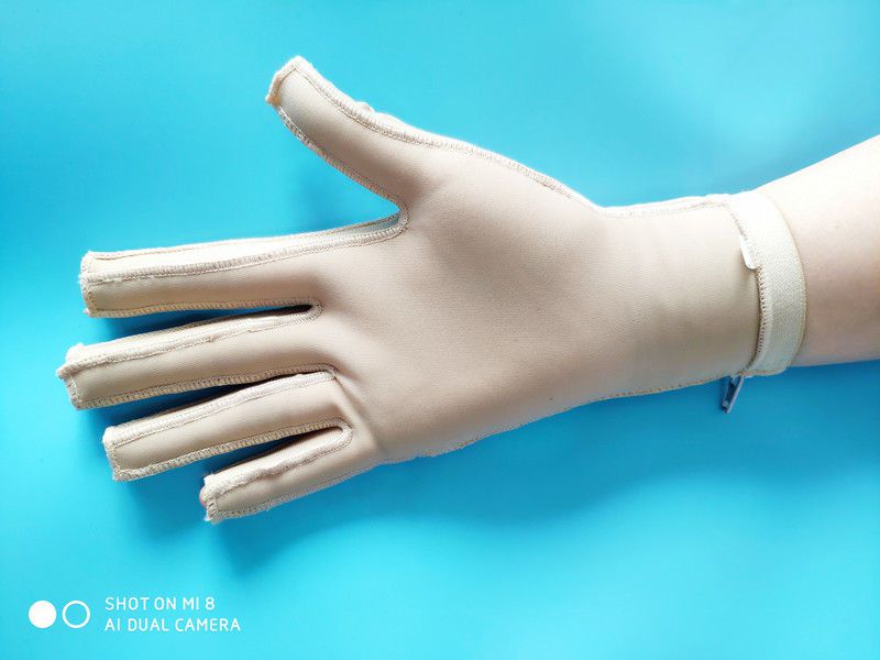 弹力套疤痕加压压力手套弹力套手指手掌手背烧伤植皮抑疤痕术后加压