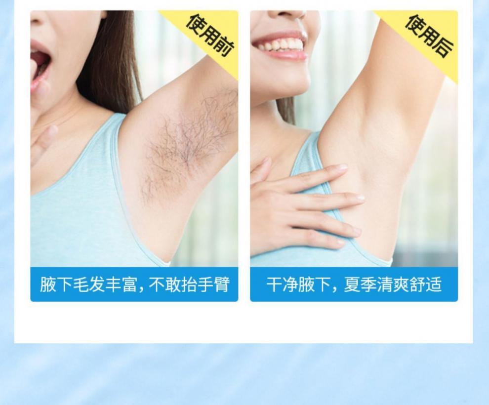 刮毛刀女腋毛修剪器女性剃毛器私处阴部脱毛仪剃须旦榄红1刀架10刀头