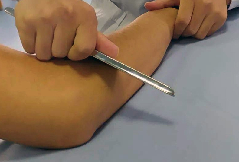 筋膜刀套装筋膜刀肌筋膜松解刀套装不锈钢肌肉软组织放松运动理疗工具