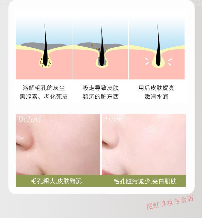 睫蓓清痘去黑头绿豆泥膜清洁面膜补水收缩毛孔平衡控油男女士面膜 绿茶泥膜1盒(100g)