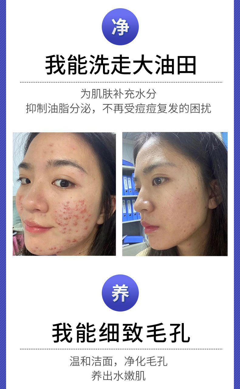 华南理工大学研发洗面奶韩鹭洗面奶水杨酸控油去豆洗面奶华南理工大学