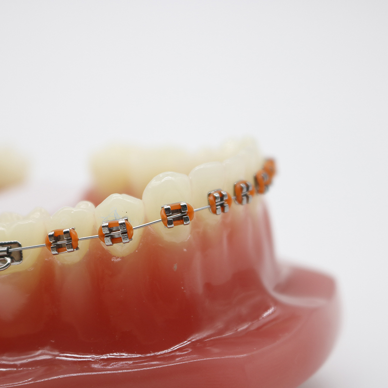 正畸牙齿模型模型正畸半金属半托槽标准牙模牙齿摆件种植口腔教学模型