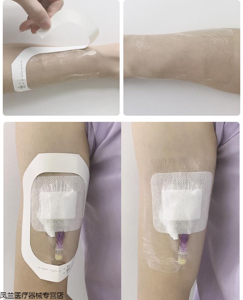 妥能医用透明敷料贴防水贴picc静脉导管固定置管敷贴膜输液滞留针贴片