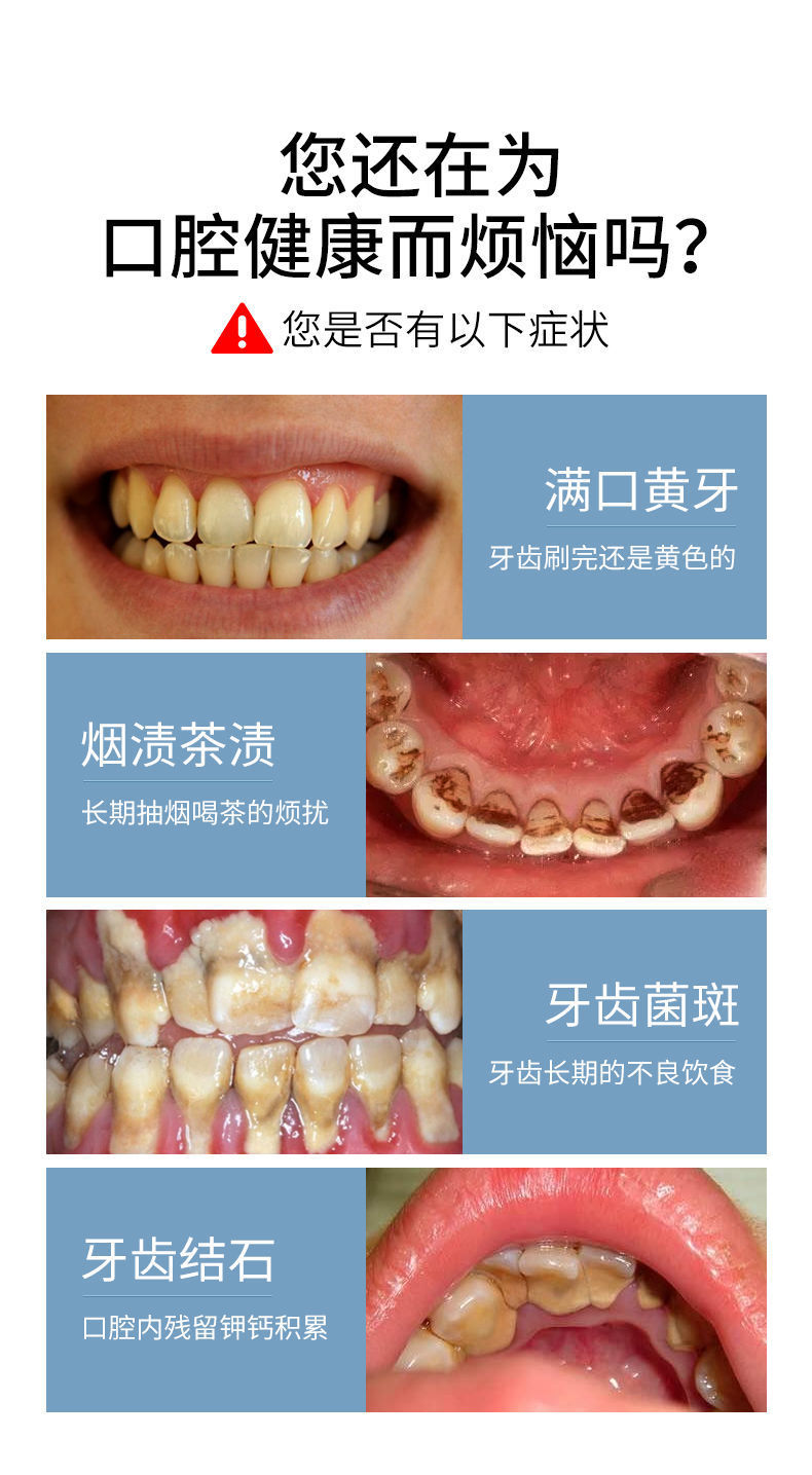 超声波洗牙器 牙结石去除器洗牙仪电动家用溶解牙垢清除器茶烟渍牙齿