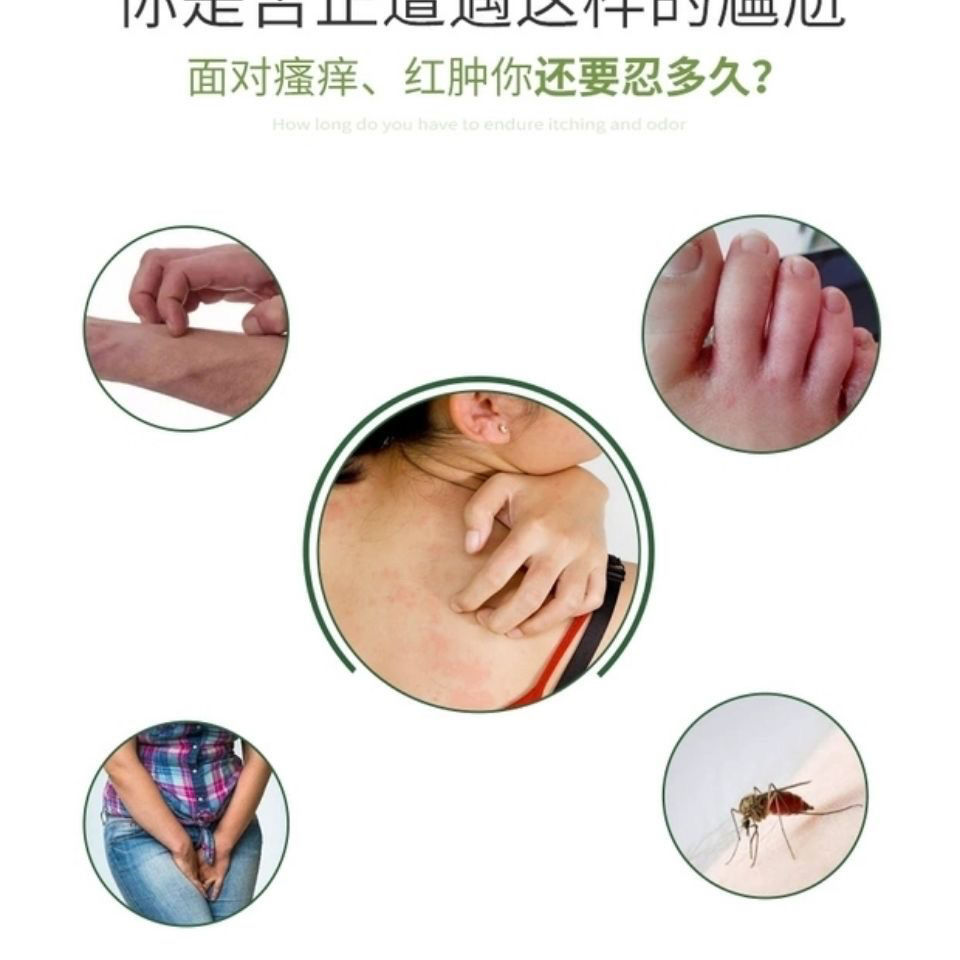 maigoole顺丰直邮钟教授草本汉方乳膏肛门阴囊瘙痒湿痒皮丨疹皮肤瘙痒