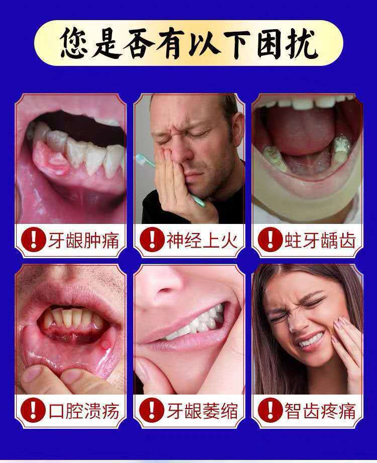 牙痛立可停牙疼牙龈肿痛蛀牙虫牙牙洞智齿疼牙疼药牙周炎牙痛喷剂 买2