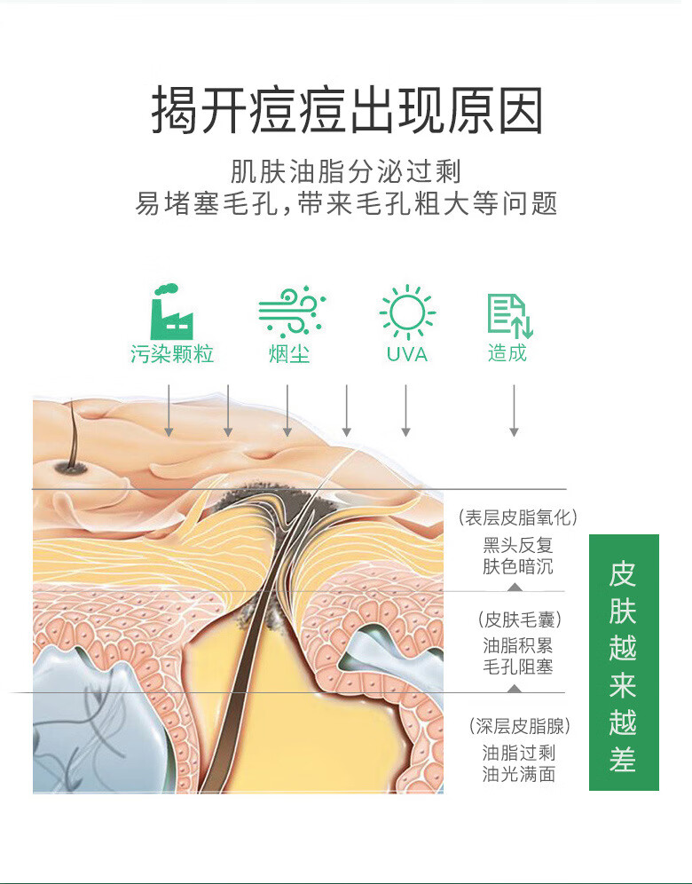 韩瑟【批发价】细致嫩肤去痘霜20g淡化痘印改善毛孔粗糙清爽润泽肌肤 韩瑟细致嫩肤去痘霜20g