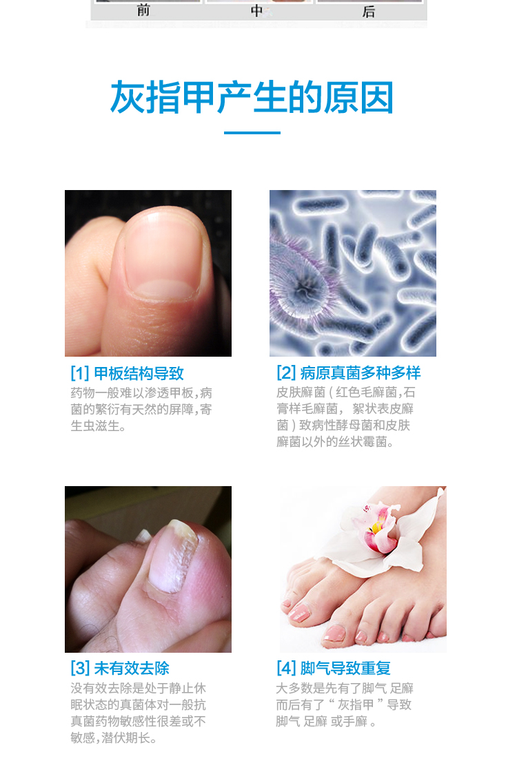 膜灰指甲专用液灰呷一笔亮膏灰指甲克星修复膜灰甲净灵亮王康护理膜液