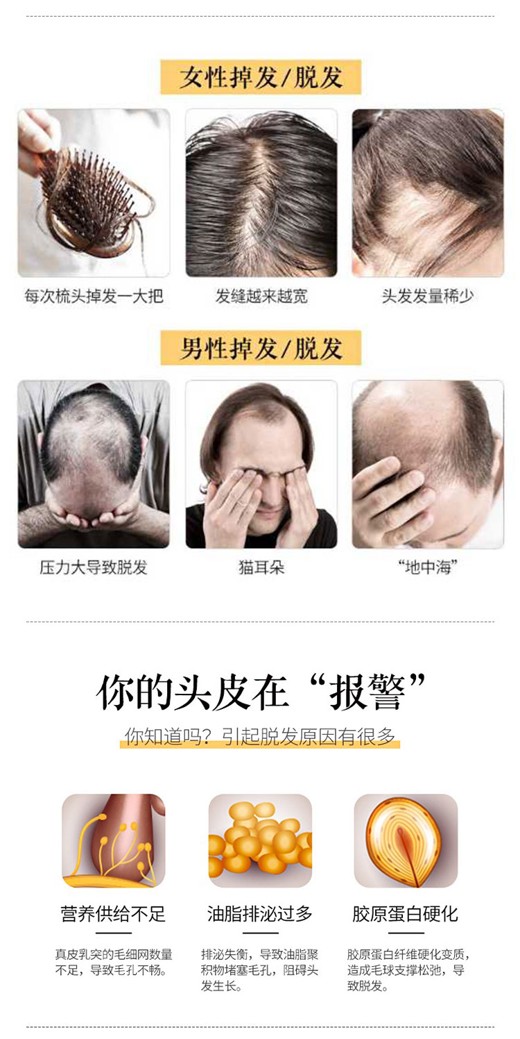 南京同仁堂防脱发育发液适合脂溢性脱发发际线增高掉头发男女士生长