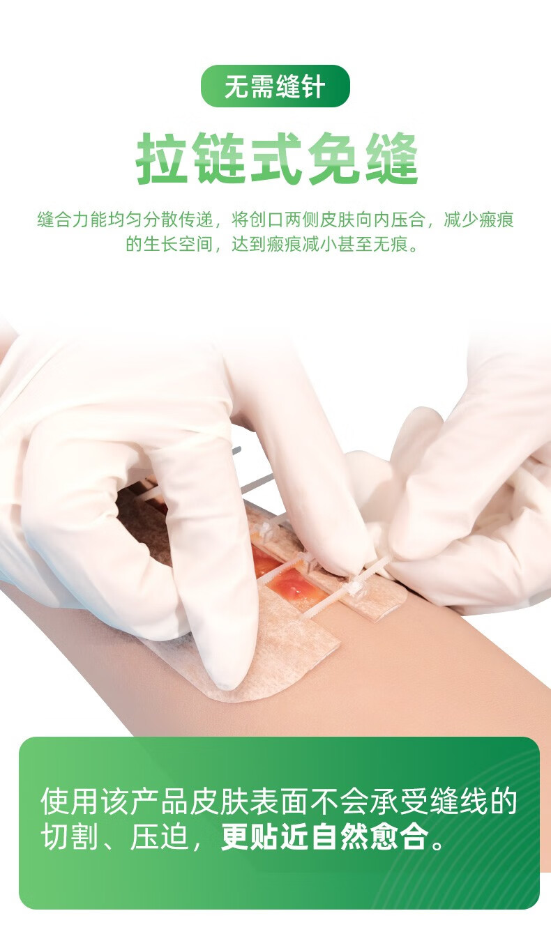 奥凡德ovand免缝合伤口贴拉链创可贴无痛缝合贴免缝针创口贴减张贴减