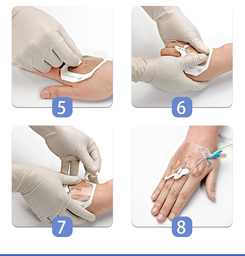 弘生留置针贴膜胰岛素贴导管固定贴剖腹产防水贴picc中心静脉jy67cm50