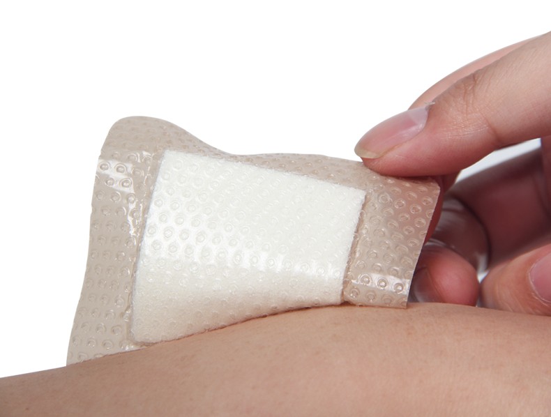 爱肤宁硅凝胶压疮贴瘢痕疤痕贴整形烧伤增生卧床褥疮有边型泡沫敷料10