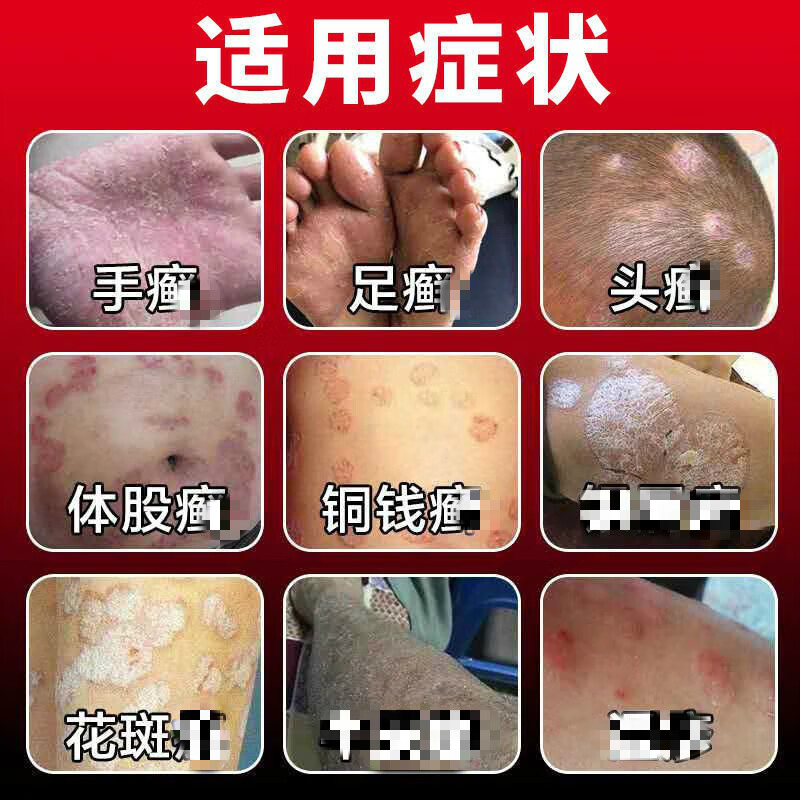 邹润安双好海藻芦荟胶浓缩型润肤抗痘抑菌修复荟胶凝胶补水保湿舒缓