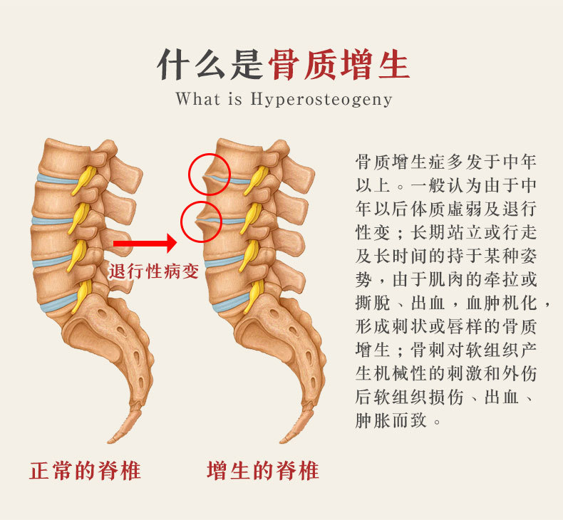 仲雲堂腰椎頸椎膝蓋骨質增生藥監備案冷敷理療貼可配搭膝關節骨質增生