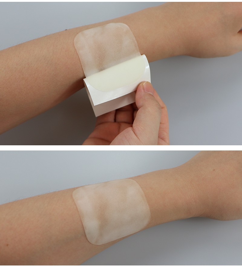 施乐辉爱立敷薄型泡沫敷料picc静脉炎贴烧伤压褥疮下肢溃疡术后伤口供