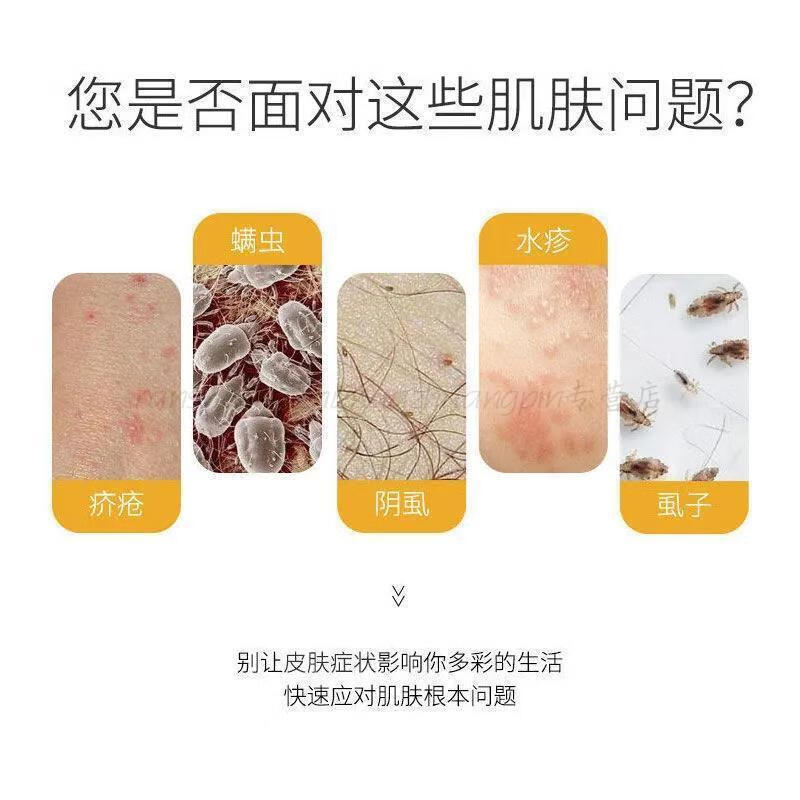 20%浓度硫磺软膏结节疥虫阴虱螨虫阴囊皮肤瘙痒止痒膏 阴虱套装(一套