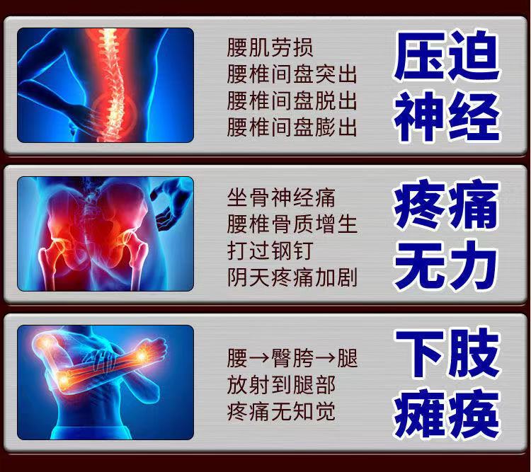 姚本仁乔记本草腰专用压迫神经腿麻木腿疼腰酸背痛腰间盘冷敷凝胶 一