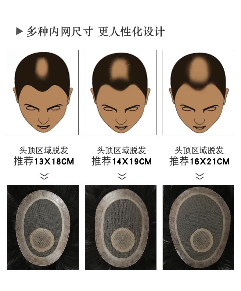 保密发货男士地中海假发男士假发男短发头顶补发片真人发丝隐形无痕