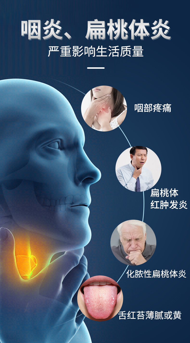 祖医堂咽扁康医用冷敷贴专贴咽部扁桃体发炎咽喉疼痛扁桃体红肿发炎