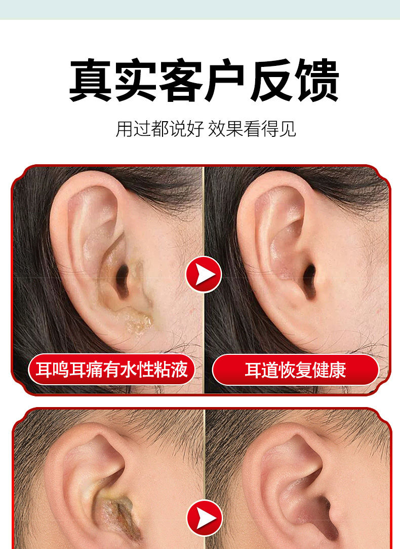康耳滴人用滴耳液耳朵痒中耳炎耳屎软化耳聋耳鸣神经性耳响洗耳液一瓶
